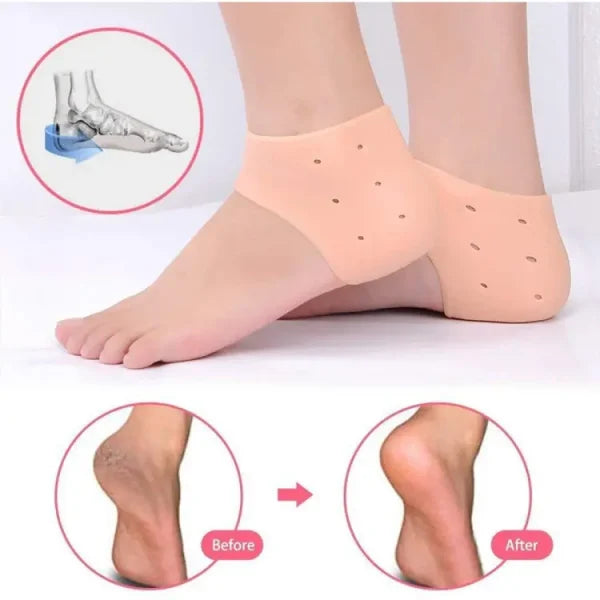 Pair of Anti-Crack Silicone Heel Protectors – Pain Relief Half Heel Pads for Cracked Heels (Unisex)