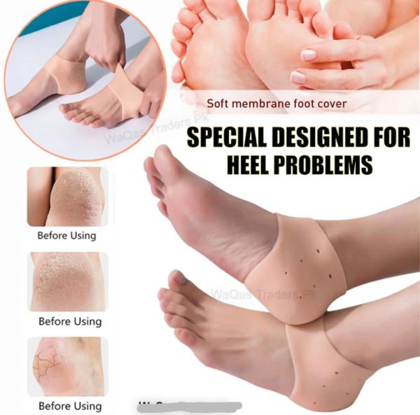Pair of Anti-Crack Silicone Heel Protectors – Pain Relief Half Heel Pads for Cracked Heels (Unisex)