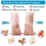 Pair of Anti-Crack Silicone Heel Protectors – Pain Relief Half Heel Pads for Cracked Heels (Unisex)